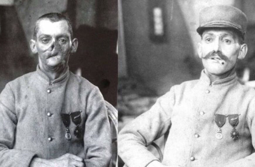 Anna Coleman e la guarigione dei soldati attraverso le maschere