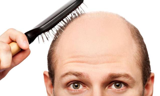 Come reagisce la psiche all'insorgere della calvizie