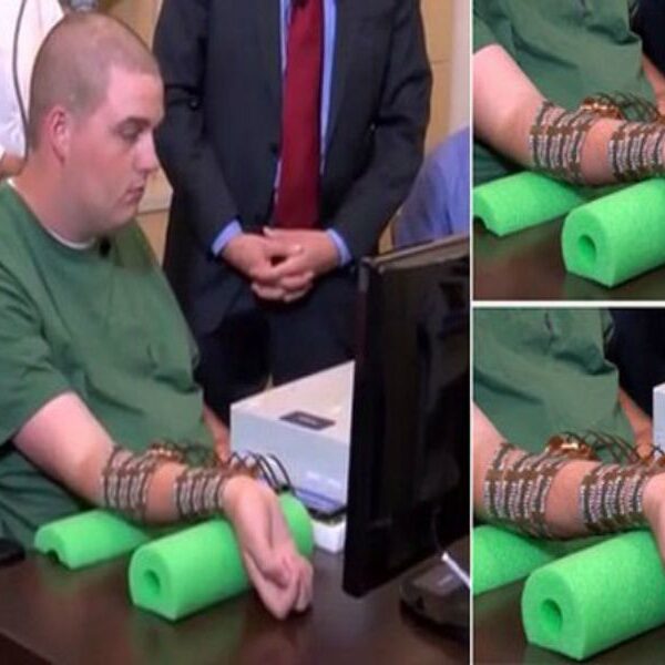 Arriva Neurobridge: il chip per muovere arti paralizzati