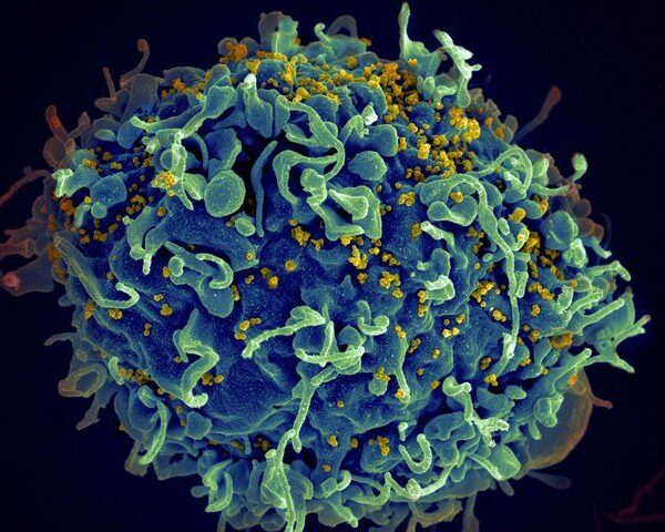 HIV: verso una cura?