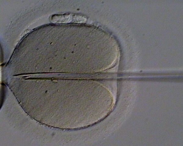 Fecondazione eterologa: ecco le linee guida