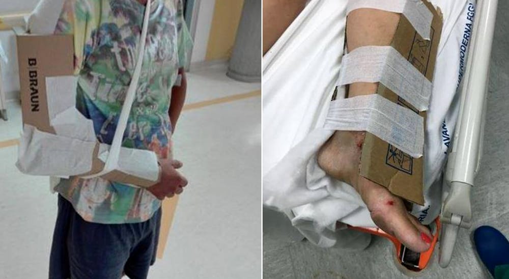 Reggio Calabria: in ospedale manca il gesso