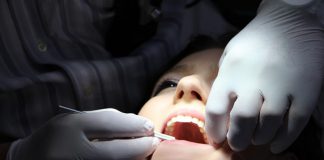 Impianti dentali: che cosa sono e quali scegliere