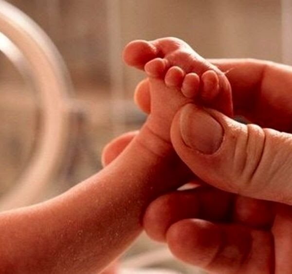 Donna in coma da 3 mesi partorisce una bambina