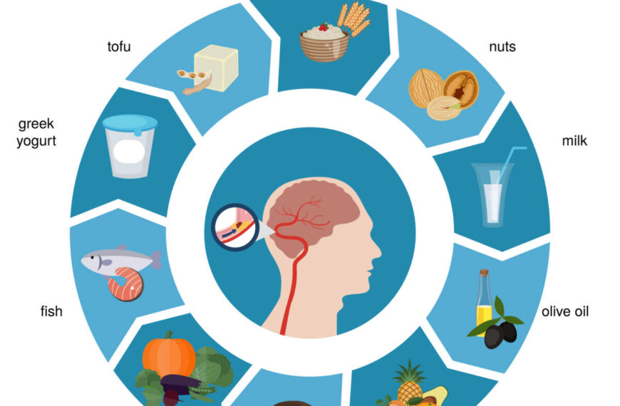 I 10 migliori cibi per l’intestino-cervello